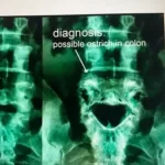 dianosis.webp